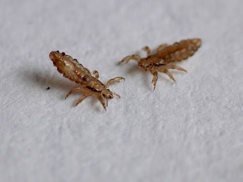 نمای میکروسکوپی از شپش